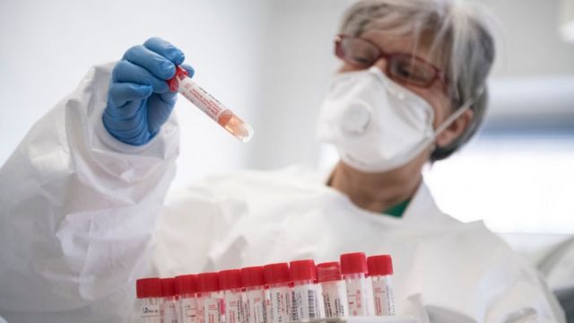 Rusiyada koronavirusun bütün ştamlarını müəyyən edən test sistemi hazırlanıb